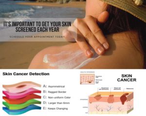 skin cancers, types of skin cancer, skin cancer treatment, malignant melanoma, skin cancer moles pics, how skin cancer look like