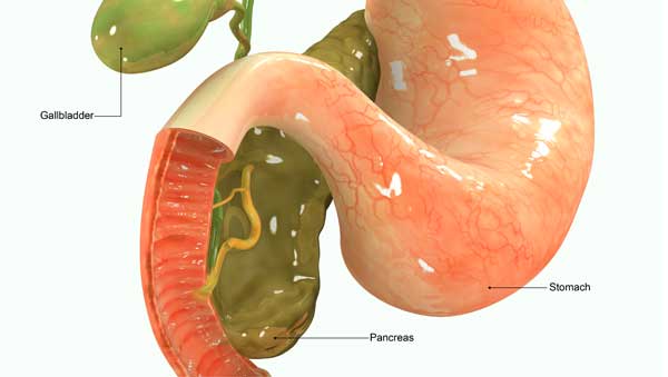 Gallbladder, Gallstones, gallbladder pain, gallbladder symptoms, gallbladder surgery, gallbladder removal, gallstones symptoms, what causes gallstones, gallbladder disease, gallbladder stones